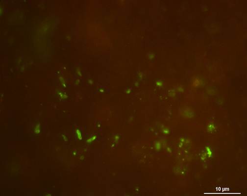 Popis: sputum Leg
