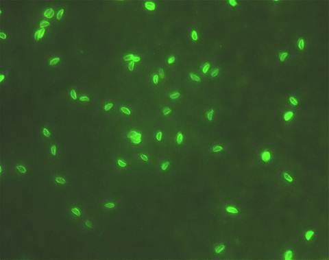 Popis: Toxoplasma3