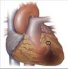 http://eurheartj.oxfordjournals.org/content/early/2012/08/23/eurheartj.ehs184/F2.large.jpg
