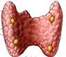 http://3.bp.blogspot.com/-Zhsn20DQwU0/TqAxiX65p3I/AAAAAAAABBU/LWgO-rNJs6g/s1600/thyroid+parathyroid.jpg