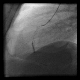 http://zlatokop.medicon.cz/csp/docminer/dicom/images/XA.1.3.12.2.1107.5.4.5.35372.30000011080810404120300002168.512.W1.jpg.0.jpg