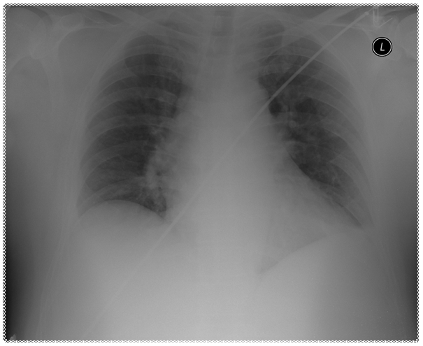 http://zlatokop.medicon.cz/csp/docminer/dicom/images/CR.1.2.840.113564.10.1.1475614297571021682615723418020432616467.W1.jpg